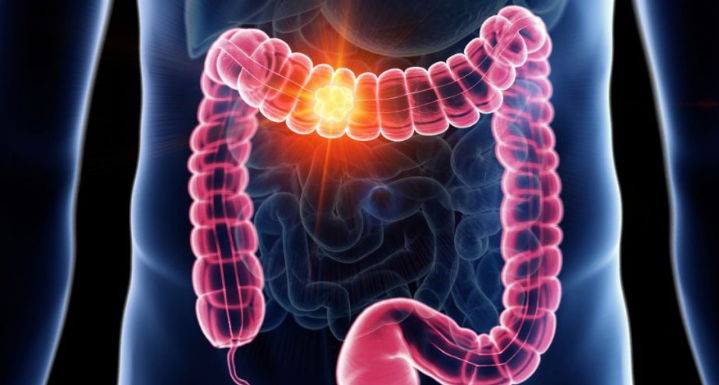 Schimbări subtile în sănătatea intestinală care merită investigare medicală